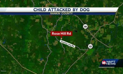 Child attacked by dog in Rankin County
