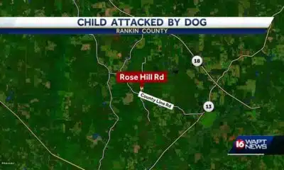 Child attacked by dog in Rankin County