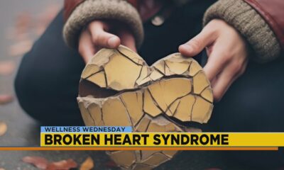 What is broken heart syndrome?