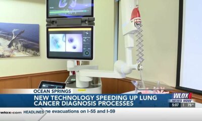 New technology at Singing River Health System’s Ocean Springs Hospital speeding up lung cancer di...