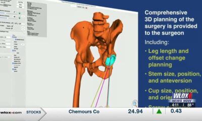 SRHS Dr. Philip Myers becomes first surgeon in Mississippi to successfully use augmented reality...