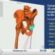 SRHS Dr. Philip Myers becomes first surgeon in Mississippi to successfully use augmented reality...