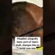 Hospital allegedly loses part of man’s skull