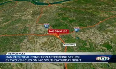 Man at UofL Hospital in critical condition after being struck twice walking on I-65