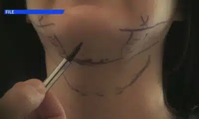 Exposing Bad Plastic Surgery and the Secret to Avoiding It