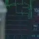 SSM Health Medical Minute: Unique stroke risks in women 