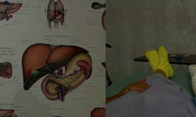 Two lives saved, four surgeries total: SA couple scheduled for organ swap procedure next week