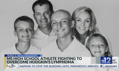 Mississippi high school athlete fights to overcome Hodgkin's lymphoma