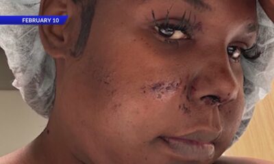 STL woman receives new car after rental denial post-shooting