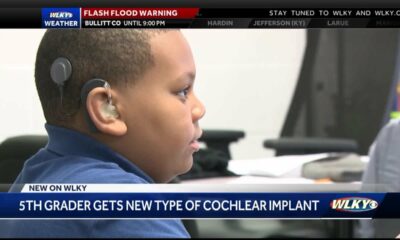 JCPS 5th grader gets new type of cochlear implant
