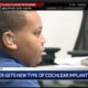 JCPS 5th grader gets new type of cochlear implant