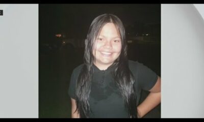 South Florida dad shares update on daughter severely burned in Molotov cocktail attack