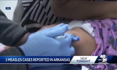 Measles cases confirmed in Arkansas children after travel exposure