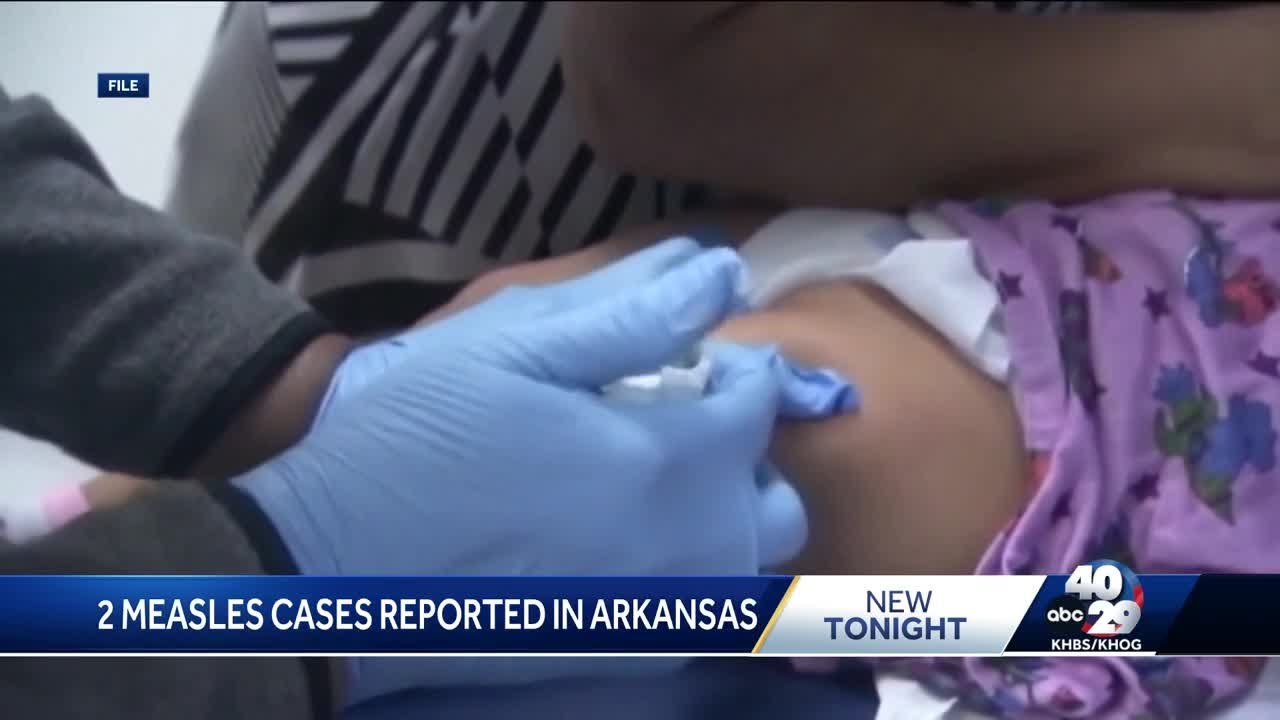 Measles cases confirmed in Arkansas children after travel exposure
