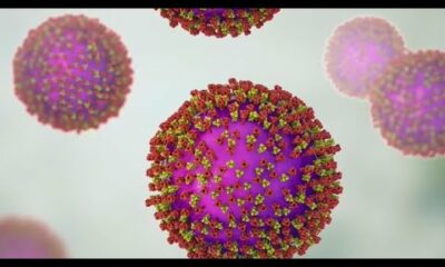 Unvaccinated adult, child test positive for measles in North Texas