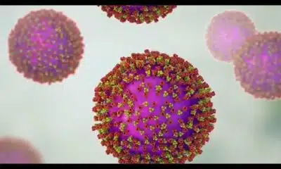 Unvaccinated adult, child test positive for measles in North Texas
