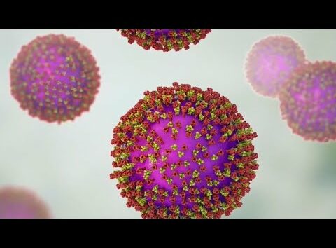 Unvaccinated adult, child test positive for measles in North Texas
