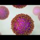 Unvaccinated adult, child test positive for measles in North Texas