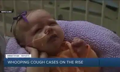 Local doctor discusses the rise in whooping cough cases locally and nationally