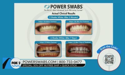 Power Swabs offers 50% off teeth whitening!