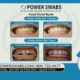 Power Swabs offers 50% off teeth whitening!