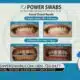 Power Swabs offers 50% off teeth whitening!
