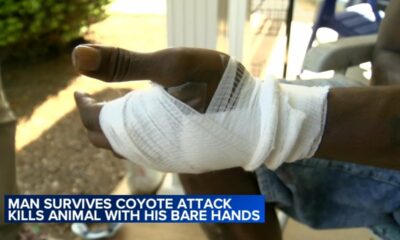 Man strangles coyote to death after it follows, attacks him