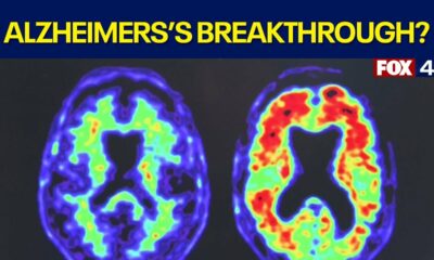 New investigational drug for Alzheimer's disease