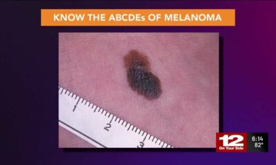 How to lower your risk of skin damage and cancer