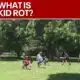 Do you let your kids ‘rot’ over the summer? | FOX 5 News