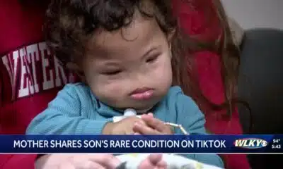 Louisville mom goes viral sharing baby's rare diagnosis on TikTok