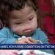 Louisville mom goes viral sharing baby's rare diagnosis on TikTok
