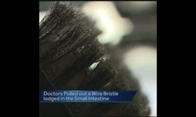 The dangers of using a wire brush