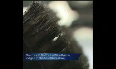 The dangers of using a wire brush