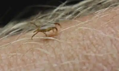 Tick bite at golf course sends STL man to ICU