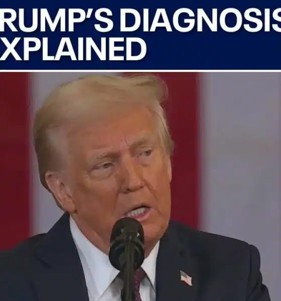 Trump diagnosed with chronic ailment | FOX 5 News
