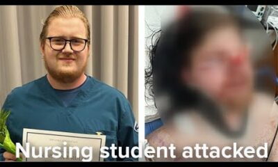 Neighbor yelled homophobic slurs before brutally beating 22-year-old CNA, loved ones say