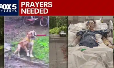 Woman critically injured in vicious dog attack | FOX 5 News