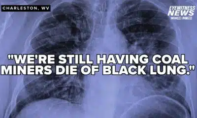 Black lung cases continue to rise while preventative measures stall out